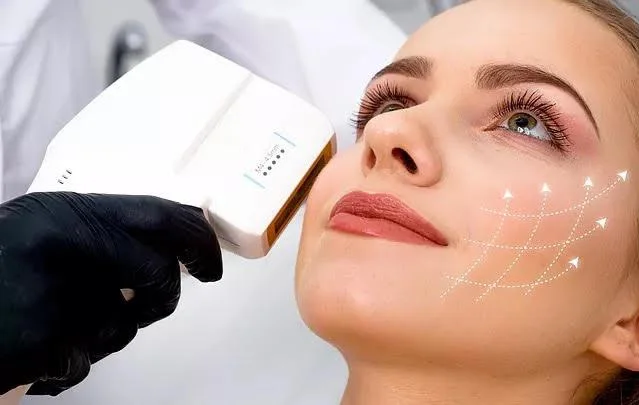 HIFU skin tightening visual